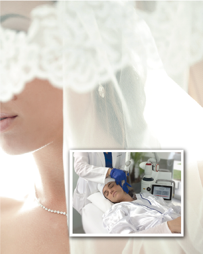 Peeling Velo de Novia