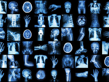 Medical Imaging's ever growing role in Healthcare