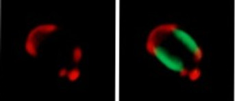 DAG microdomains with scale bar 2um_edited_edited_edited_edited.jpg