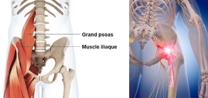 Localisation du psoas