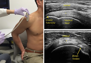 Diagnostic Ultrasound help us see in real time muscles, tendons and ligaments to identify the root cause of your pain.