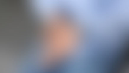 手指屈肌狹窄性腱鞘炎(彈弓手)