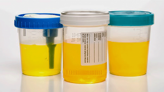 小便黃就是熱氣？