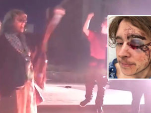 산타애나 반 ICE 시위서 연방 요원 발포로 2명 실명