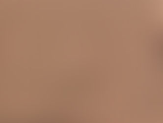 LA 한인타운 근처서 ‘뎅기열’ 5명 감염..“확산 가능성 높아”