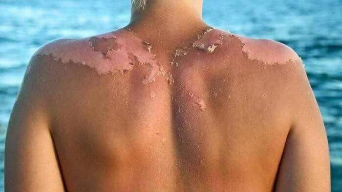 Thumbnail: Prestige Sunblock Spray