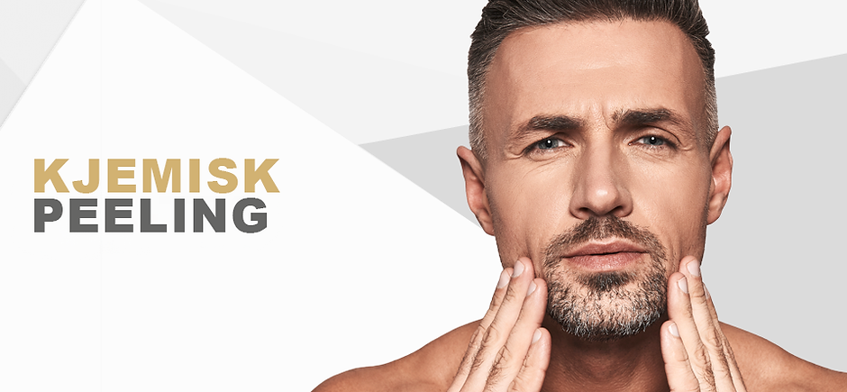 Kjemisk peeling - Stor bilde.png
