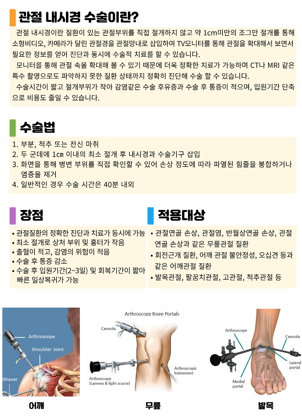 관절 내시경 수술.png