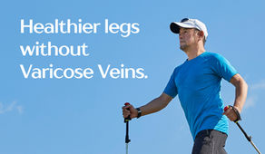 Varicose Vein