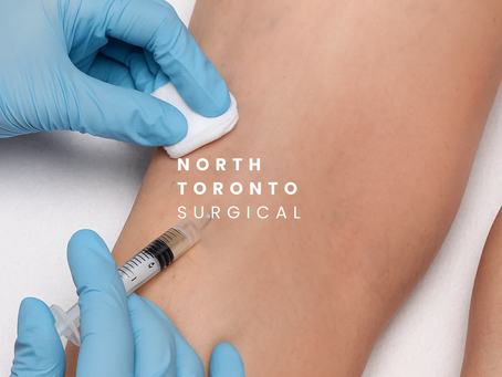 Explore Effective Sclerotherapy Treatment for Varicose Veins