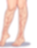 spider veins