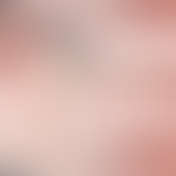 Allergies saisonnières et lentilles de contact souples