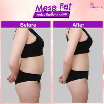 MESO FAT 01.jpg
