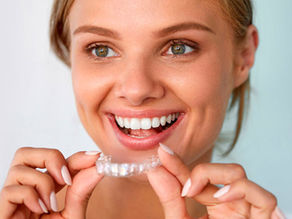 Preço do Aparelho Invisível: Quanto Custa o Invisalign e Vale a Pena?