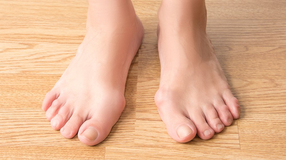 Rheumatoid Arthritis and your Feet