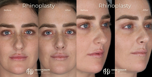 Female Rhino.zip - 2.PNG