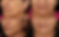 Copy of Browlift.zip - 2.PNG