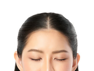 Commentary on: Use of LetibotulinumtoxinA for AestheticTreatment of Asians: A Consensus