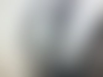 Jammed Finger or Dislocated? When a Finger Dislocation Needs More Than Buddy Taping