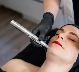 huidstudio leek microneedling anti-aging behandeling huidverjongend anti-rimpel huidversla
