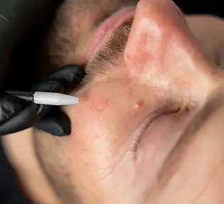 huidstudio leek medisch specialisaties schoonheidsspecialist dermatologie marisa dost huid