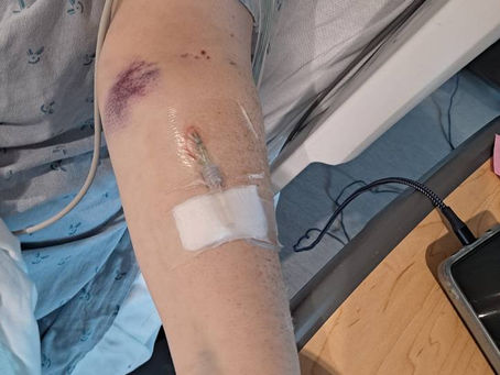 Where Have I Been? A Short Update.