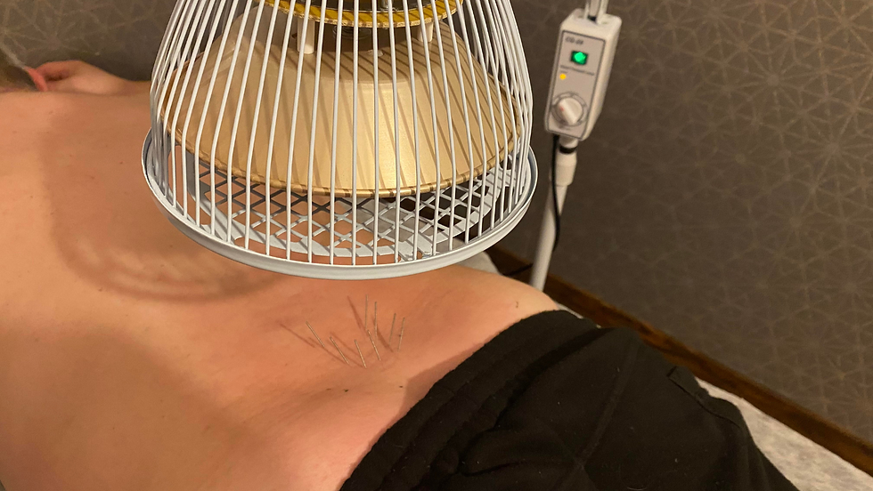 Akupunktura lampa TDP