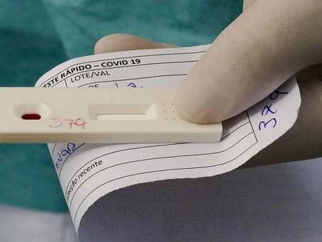 MS tem 273 novos casos de covid na última semana e três mortes registradas