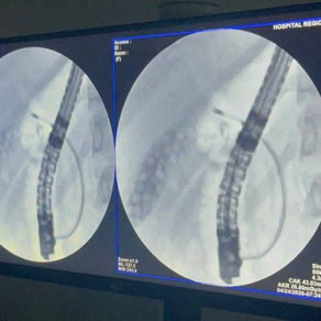 Exame inédito marca avanço da alta complexidade no Hospital Regional de Dourados