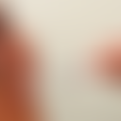 Prevendo 46,5 mil doses, SES alinha estratégia de vacinação contra chikungunya em Dourados e Itaporã