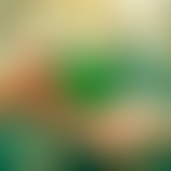 Setembro Verde: ALEMS reforça apoio à doação de órgãos e tecidos