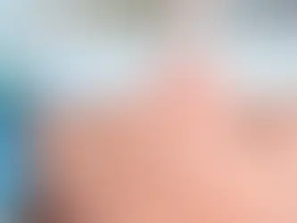 Complicações Vasculares em Preenchimento Facial: Protocolo