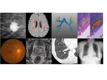 A Decade of AI in Medical Imaging