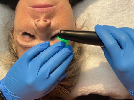 What is NuLids & Why It Matters for Your Eyes