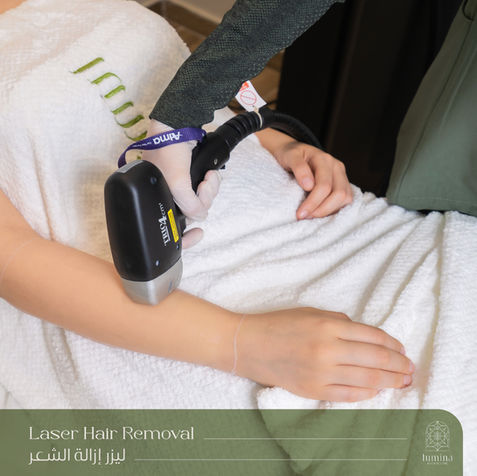 Laser Hair Removal