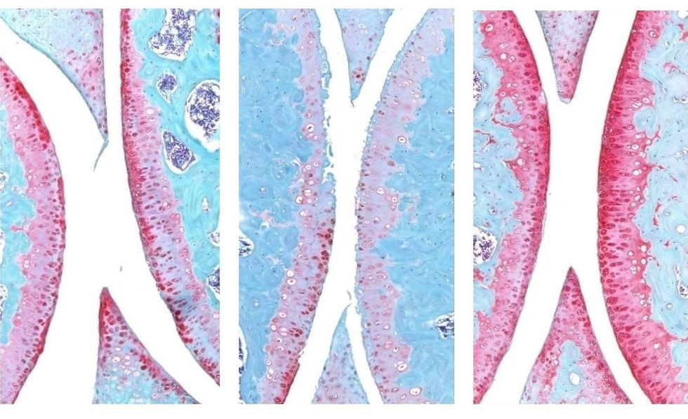 Good News From Around The World: Anti-Aging Drug Regrows Knee Cartilage in Major Breakthrough That Could End Knee Replacements...