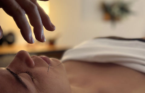 Acupuncture at Chakramaya_edited.jpg