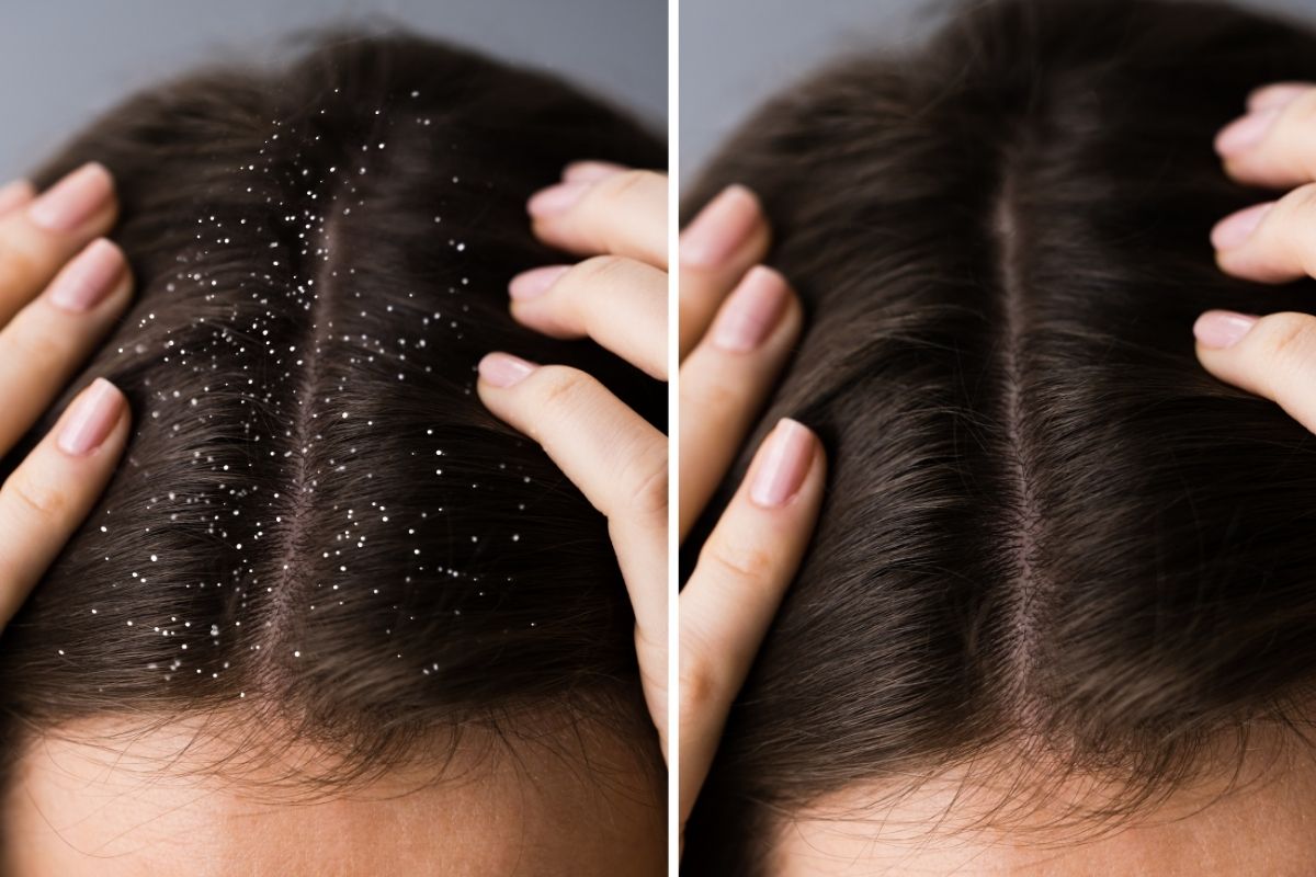 Woman with a healthy, nourished scalp after a professional treatment.