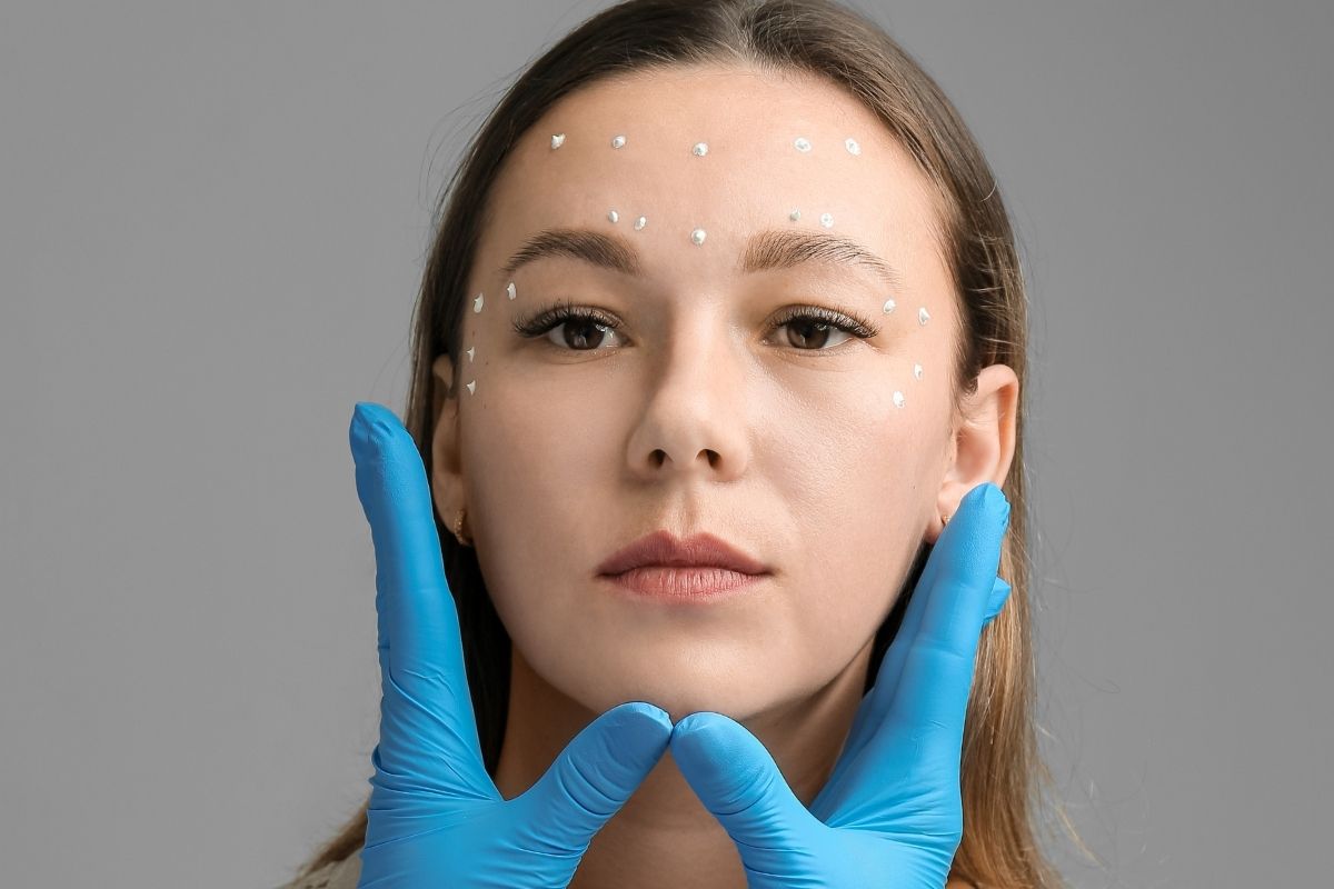 Cosmetologist marking treatment areas on a client’s face for precise Botox filler application.