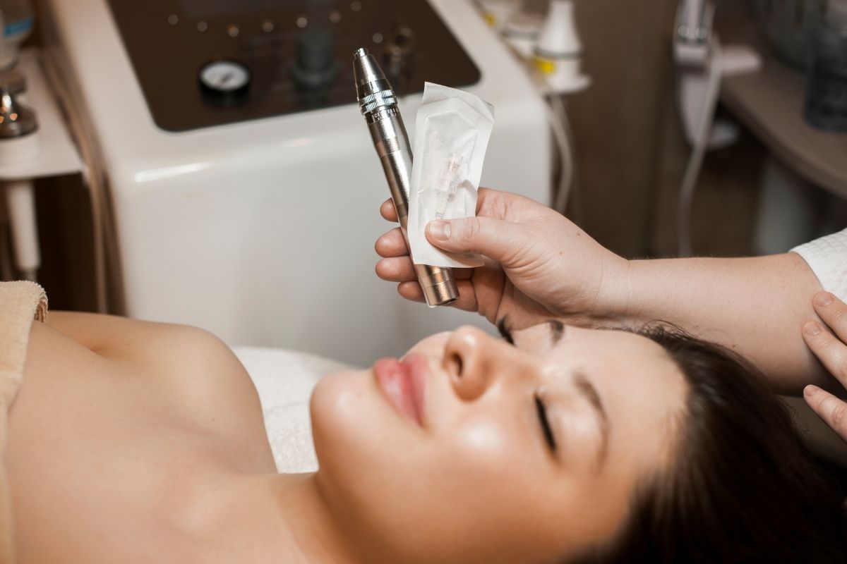 A client receiving a microneedling session to treat acne scars and improve skin texture.