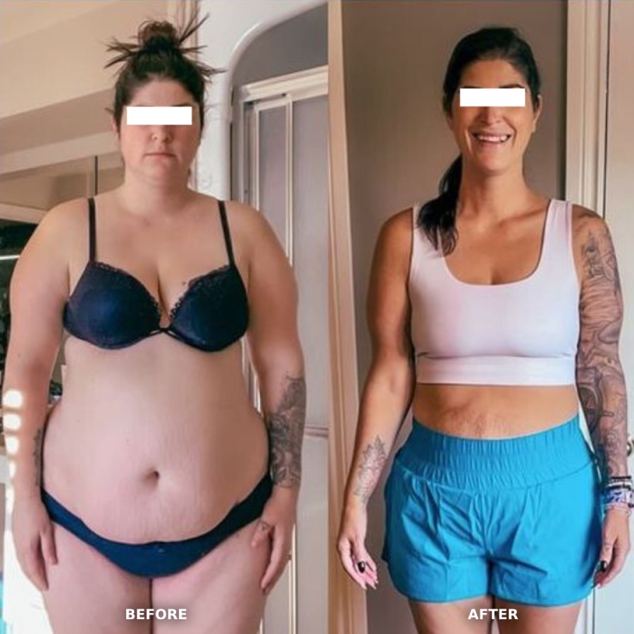Patient transformation photo — before and after physician-supervised program