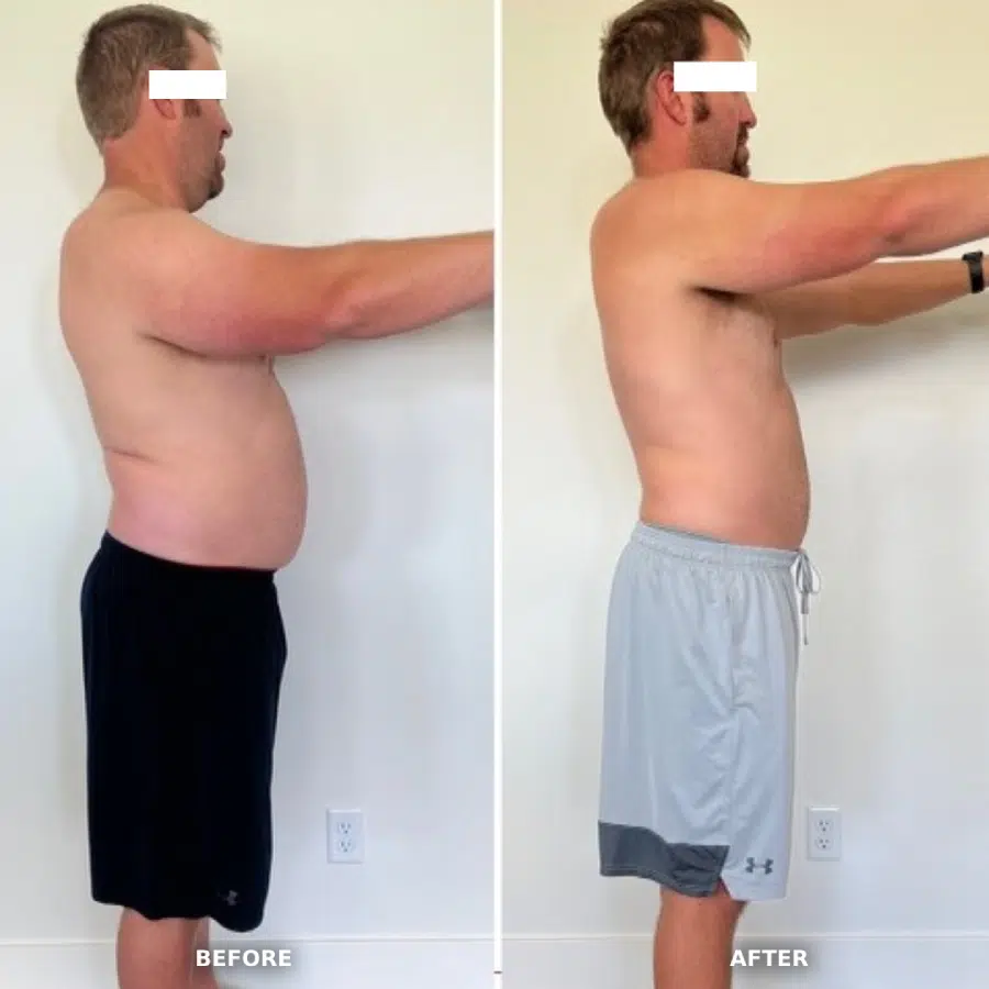 Patient transformation photo — before and after physician-supervised program