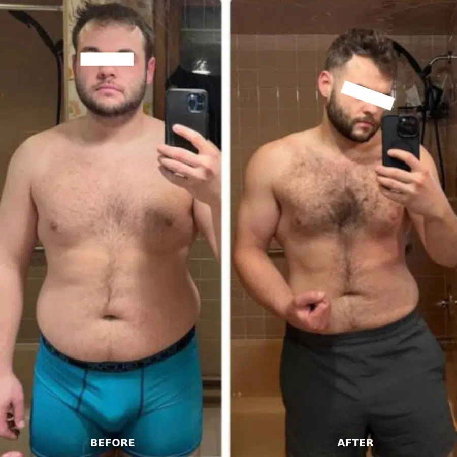 Patient transformation photo — before and after physician-supervised program