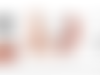 Videoendoscopia: Processamento, Armazenamento e Novas Tendências.