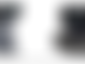 Equipamento de ultrassonografia e funções principais.