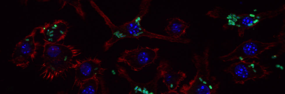 DC2,4 Wt_BS176-4h_LPS-Green-_Phalloidin-Red-_DAPI-Blue-_1_edited.jpg