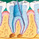 rootcanal2.jpg