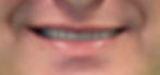 Artem - smile