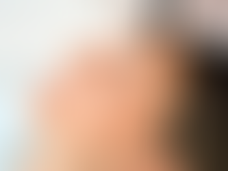 Skin Needling Aftercare