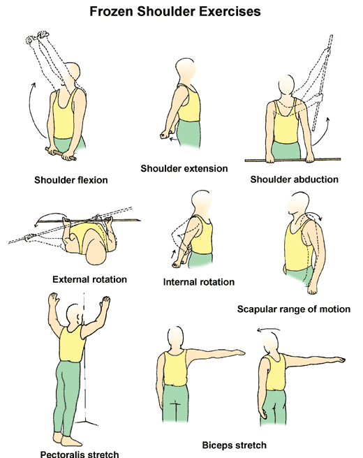 Reclaim Shoulder Control: Exercise Strategies for Instability